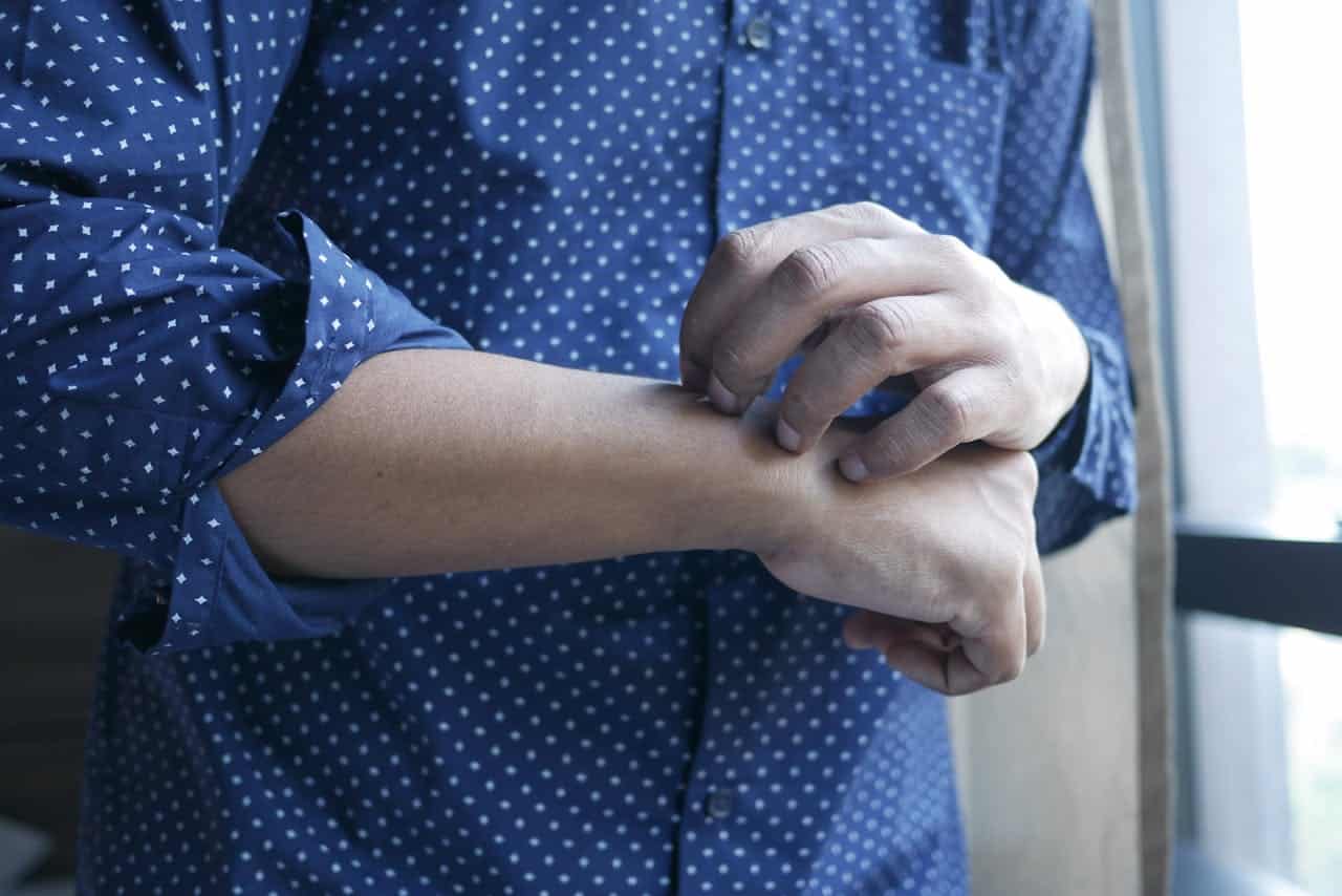جلد کھوجنے کا عارضہ: قوتِ ارادی کیوں کبھی کام نہیں کرتی
