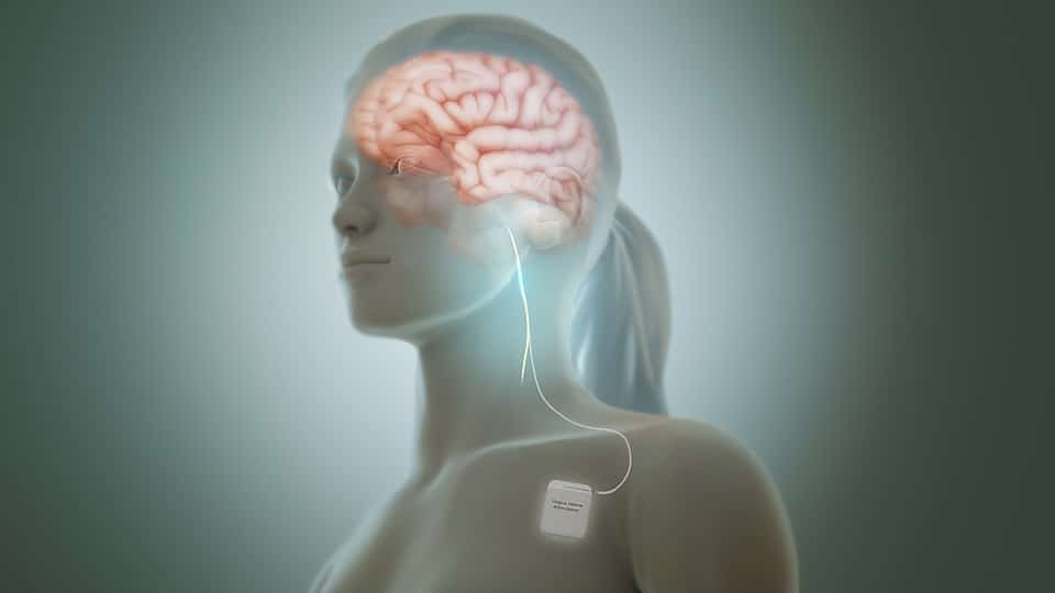 El nervio vago: el regulador silencioso de tu salud mental