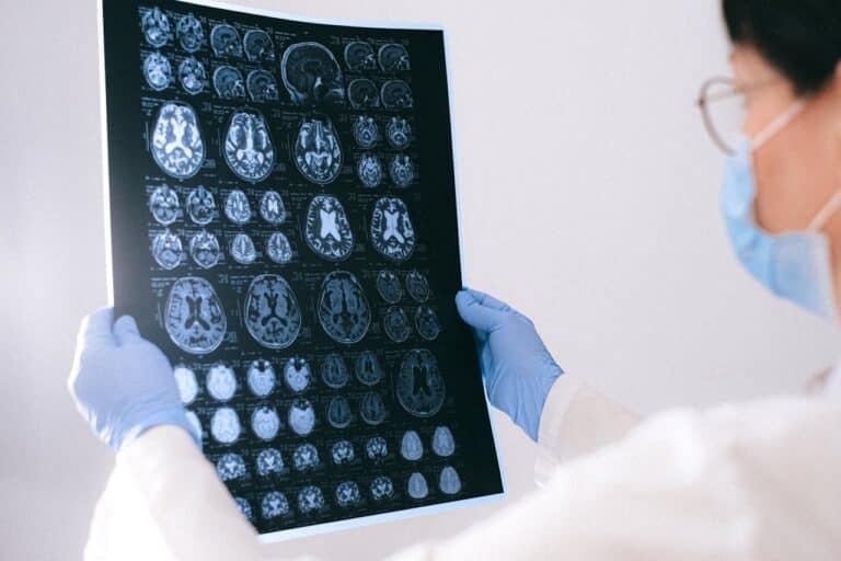 Le réseau par défaut : pourquoi votre cerveau ne cesse de vagabonder