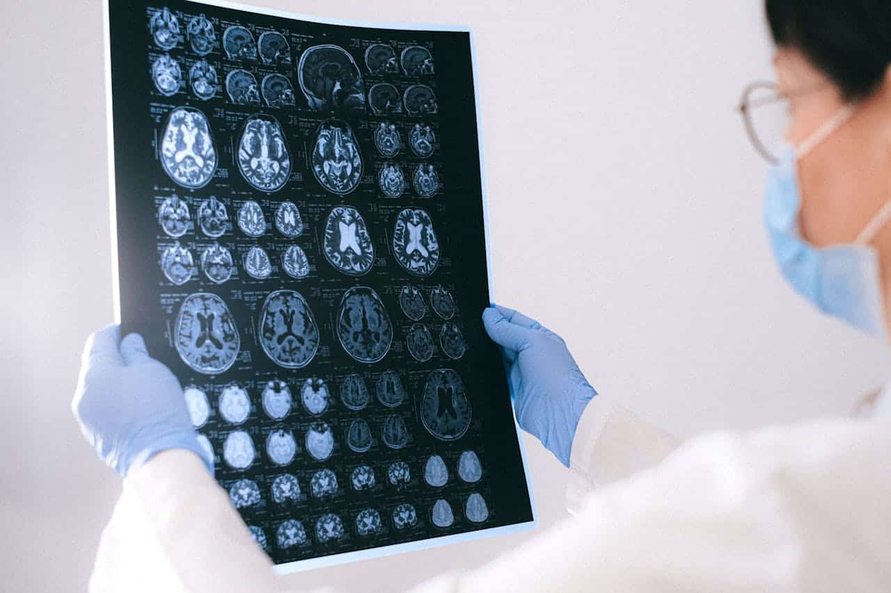 Le réseau par défaut : pourquoi votre cerveau ne cesse de vagabonder
