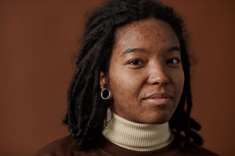 What Adult Acne Actually Does to Your Mental Health