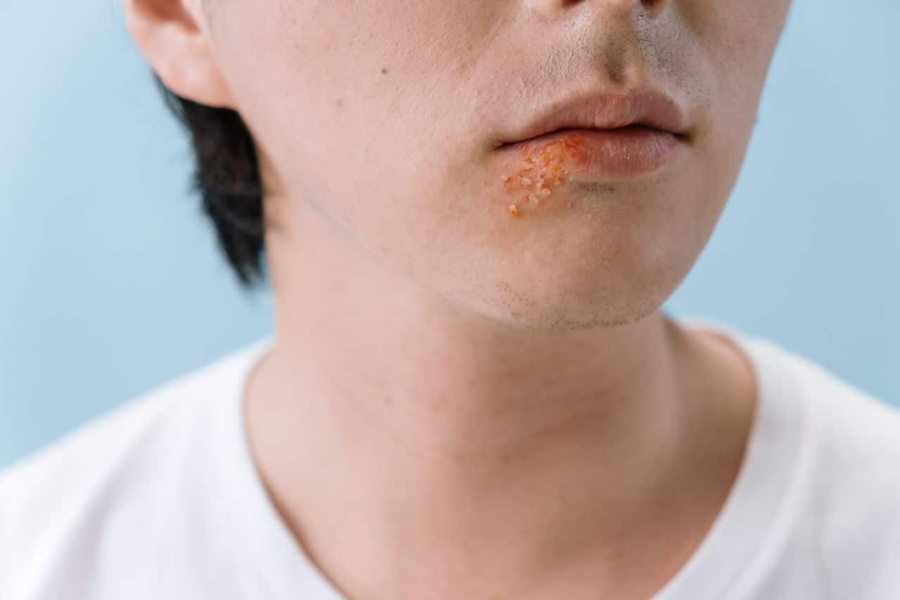What Lupus Actually Does to Your Mental Health