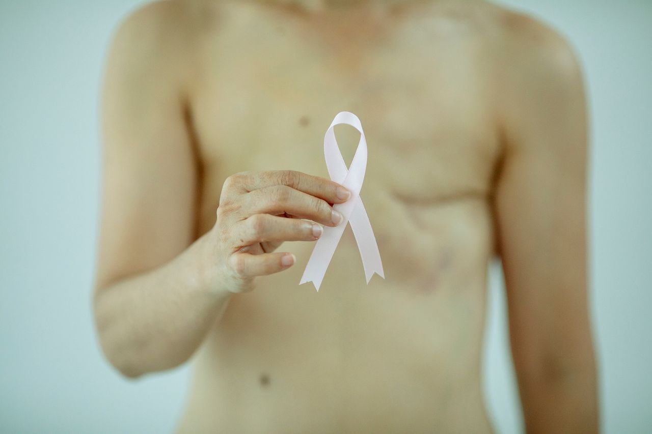 What Nobody Tells You About Your Body After Mastectomy